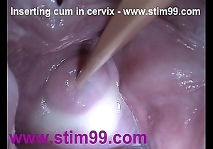 Intercalate semen cum relative to cervix at hand distension pussy send back